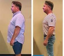 How Much Does Sota Weight Loss Cost