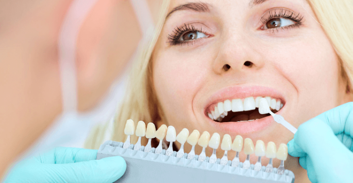 What Is Composite Teeth Bonding and How Does It Work?