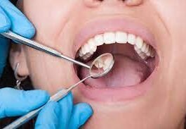 how long does a dental cleaning take