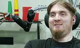 rajkotupdates.news : elon musk in 2022 neuralink start to implantation of brain chips in humans