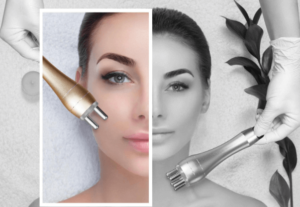 Skin Tightening Solutions