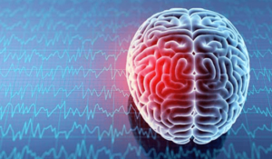 Post-Brain Injury