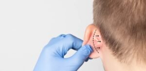 Ear Surgery