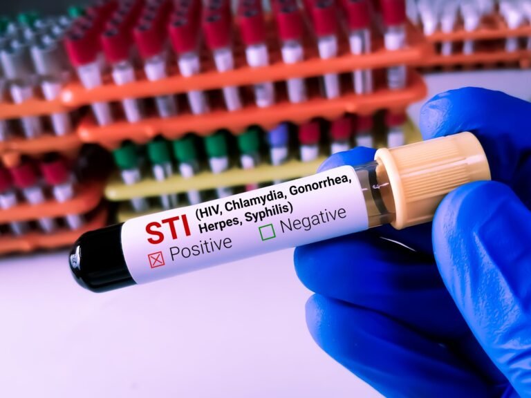 How to Combat the Spread of STDs in Your Community
